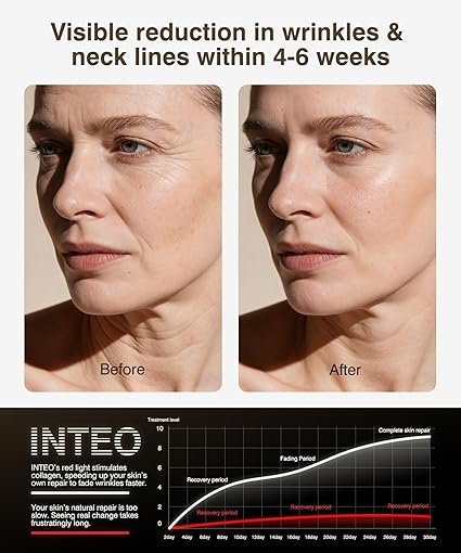 Click to see full view Red Light Therapy for Face and Neck, 4 Modes Cordless Face Mask Light Therapy with Neck Masks, 850nm Infrared & Red Light Mask, 2000mAh Rechargeable Light Therapy Skin Care At Home (680 Beads) - Image 4